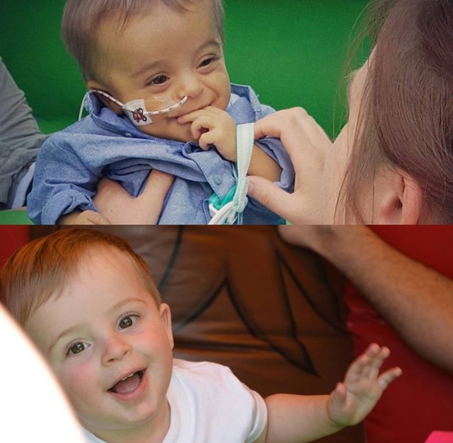 Ethan before and after his transplant. 